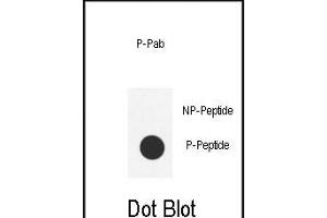 Dot blot analysis of anti-Phospho-SRC- Phospho-specific Pab (ABIN650803 and ABIN2839787) on nitrocellulose membrane. (Src Antikörper  (pTyr419))