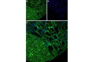Expression of TRPA1 in rat DRGImmunohistochemical staining of rat dorsal root ganglion (DRG) using Anti-TRPA1 (extracellular) Antibody (ABIN7043813, ABIN7044000 and ABIN7044001) (1:200).