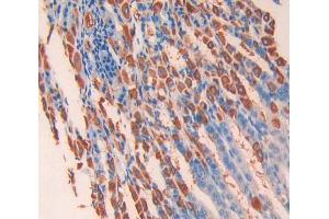 IHC-P analysis of stomach tissue, with DAB staining. (IL13 Receptor alpha 1 Antikörper  (AA 28-171))
