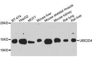 Western blot analysis of extract of various cells, using UBE2D4 antibody. (UBE2D4 Antikörper)