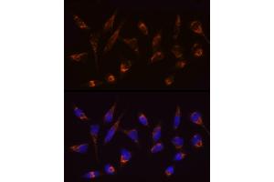 Immunofluorescence analysis of HeLa cells using [KO Validated] SLC25/ Rabbit mAb (ABIN7270428) at dilution of 1:100 (40x lens). (SLC25A4 Antikörper)