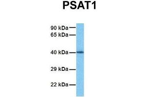 Host:  Rabbit  Target Name:  PSAT1  Sample Tissue:  Human Fetal Kidney  Antibody Dilution:  1.