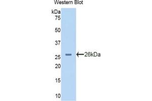 Western blot analysis of the recombinant protein. (PYGL Antikörper  (AA 73-267))