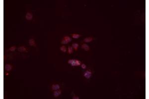 ABIN6277442 staining Hela cells by IF/ICC. (TRIM63 Antikörper  (N-Term))