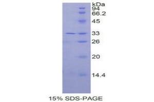 SDS-PAGE (SDS) image for Interleukin 31 Receptor A (IL31RA) (AA 205-456) protein (His tag) (ABIN2125495)
