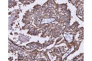 IHC analysis of MTHFD1 using anti-MTHFD1 antibody (ABIN7600631).