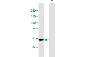 Western Blot analysis of CPEB1 expression in transfected 293T cell line by CPEB1 MaxPab polyclonal antibody.
