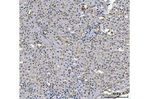 IHC analysis of HOXC4 using anti-HOXC4 antibody (ABIN7603059). (HOXC4 Antikörper  (Middle Region))