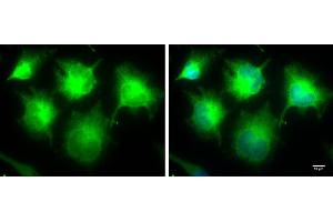 ICC/IF Image IKBKE antibody [N2C3] detects IKBKE protein at cytoplasm by immunofluorescent analysis.