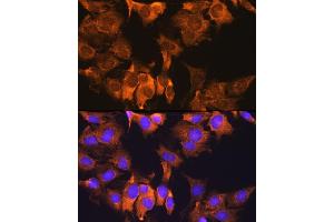 Immunofluorescence analysis of C6 cells using CDV3 Rabbit pAb (ABIN7266240) at dilution of 1:100. (CDV3 Antikörper)