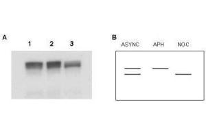 Western blot using  Affinity Purified anti-MCM2 antibody shows detection of both phosphorylated and unphosphorylated MCM2 present in nuclear extracts from elutriated human cells (MO59K/K562). (MCM2 Antikörper  (AA 21-31))