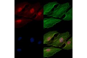 Phospho-Casein Kinase 1 alpha (Tyr294) Antibody staining A549 cells(heat shock treatment) by IF/ICC.
