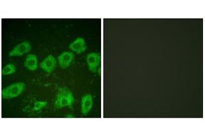 Immunofluorescence (IF) image for anti-Tyrosine Hydroxylase (TH) (Ser19) antibody (ABIN1847900)