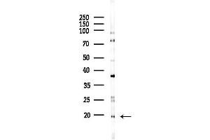 anti-Chemokine-Like Factor (CKLF) (C-Term) antibody