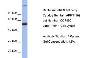 WB Suggested Anti-IRF8 Antibody   Titration: 1. (IRF8 Antikörper  (C-Term))
