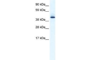 WB Suggested Anti-AATF Antibody Titration: 0. (AATF Antikörper  (N-Term))
