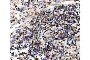 IHC analysis of NOLA1/GAR1 using anti-NOLA1/GAR1 antibody (ABIN7602076). (GAR1 Antikörper  (AA 58-165))
