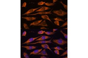Immunofluorescence (IF) image for anti-Myotubularin Related Protein 9 (MTMR9) (AA 1-250) antibody (ABIN6144163)