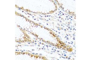 Immunohistochemistry of paraffin-embedded human stomach using FAM3B antibody (ABIN5970440) at dilution of 1/100 (40x lens). (FAM3B Antikörper)