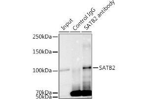 Immunoprecipitation analysis of 300 μg extracts of K-562 cells using 3 μg S antibody (ABIN7270152). (SATB2 Antikörper)