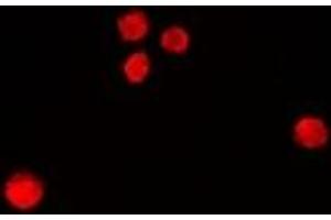 Immunofluorescent analysis of RbAp46 staining in MCF7 cells.