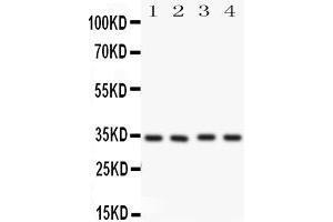 Anti-Caspase-7(P11) antibody, Western blotting All lanes: Anti CASP7(p11)  at 0. (Caspase 7 Antikörper  (Middle Region))