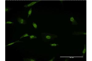 Immunofluorescence of monoclonal antibody to SLC11A2 on HeLa cell. (SLC11A2 Antikörper  (AA 1-65))