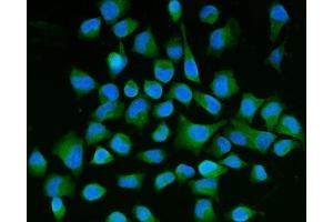 IF analysis of Semaphorin 3B/SEMA3B using anti-Semaphorin 3B/SEMA3B antibody (ABIN7602023).