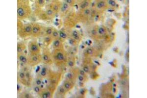 Used in DAB staining on fromalin fixed paraffin-embedded Liver tissue (Lipotropin, beta - (AA 179-267) Antikörper)