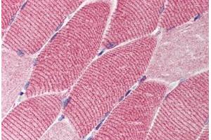 Human Skeletal Muscle (formalin-fixed, paraffin-embedded) stained with TSC1 antibody ABIN214539 at 2. (TSC1 Antikörper)
