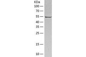 Western Blotting (WB) image for Suppressor of Fused Homolog (SUFUH) (AA 1-484) protein (His tag) (ABIN7289390) (SUFUH Protein (AA 1-484) (His tag))