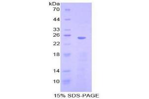 SDS-PAGE (SDS) image for High Mobility Group Box 1 (HMGB1) (AA 1-215) protein (His tag) (ABIN1079867)