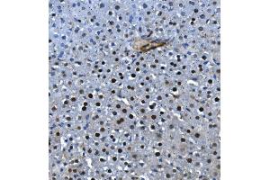 IHC analysis of LSM5 using anti-LSM5 antibody (ABIN7602503).