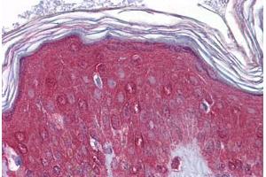Immunohistochemistry (Formalin-fixed Paraffin-embedded Sections) (IHC (fp)) image for anti-Fibroblast Growth Factor Receptor 1 (FGFR1) (N-Term) antibody (ABIN790674)