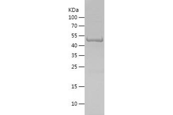 LYN Protein (AA 15-224) (His-IF2DI Tag)