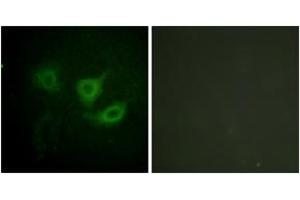 Immunofluorescence analysis of HuvEc cells, using p70 S6 Kinase (Phospho-Thr389) Antibody. (RPS6KB1 Antikörper  (pThr412))