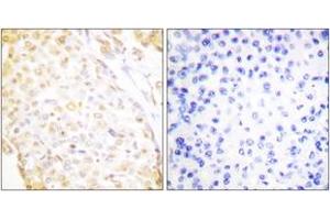 Immunohistochemistry (Paraffin-embedded Sections) (IHC (p)) image for anti-NK3 Homeobox 1 (NKX3-1) (AA 1-50) antibody (ABIN2889237) (NKX3-1 Antikörper  (AA 1-50))