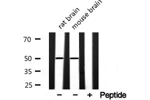 Western blot analysis of extracts of various samples,using akt1/3 Antibody. (AKT1/3 Antikörper)