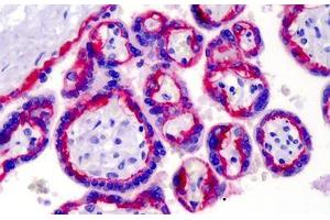 Human Placenta: Formalin-Fixed, Paraffin-Embedded (FFPE) (Integrin beta 4 Antikörper)
