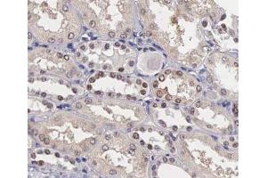 ABIN6267405 at 1/200 staining human kidney tissue sections by IHC-P. (Stathmin 1 Antikörper  (pSer25))