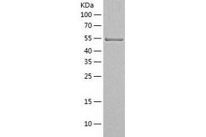 Western Blotting (WB) image for Aldehyde Dehydrogenase 1 Family, Member A1 (ALDH1A1) (AA 2-501) protein (His-IF2DI Tag) (ABIN7121770)