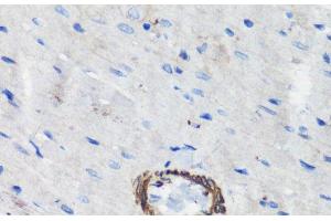 Immunohistochemistry of paraffin-embedded Rat heart using FLNA Polyclonal Antibody at dilution of 1:100 (40x lens). (Filamin A Antikörper)
