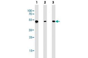 Western blot analysis of Lane 1: NCI-H292 whole cell lysates Lane 2: A549 whole cell lysates Lane 3: HepG2 whole cell lysates reacted with ALDH2 monoclonal antibody  at 1:1000 dilution.