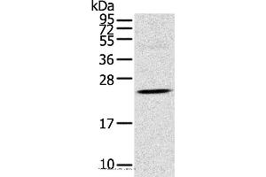 Western blot analysis of Human fetal brain tissue, using TSPAN13 Polyclonal Antibody at dilution of 1:550 (TSPAN13 Antikörper)