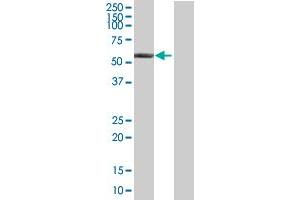 Western Blot analysis of ALDH6A1 expression in transfected 293T cell line by ALDH6A1 MaxPab polyclonal antibody. (ALDH6A1 Antikörper  (AA 1-535))