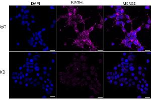 Immunocytochemical staining of HeLa cells using NSDHL antibody (ABIN7799538), 1:1,000), Top panel: wild-type (WT), Bottom panal: NSDHL shRNA knockdown (KD).