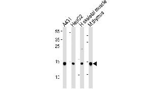 Western blot analysis of lysates from A431, HepG2 cell line, human skeletal muscle and mouse thymus tissue lysate(from left to right), using hUBE2D1- B.