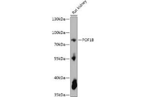 Western blot analysis of extracts of Rat kidney, using POF1B antibody (ABIN7269509) at 1:1000 dilution. (POF1B Antikörper  (AA 330-560))