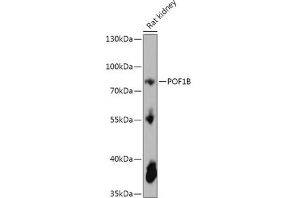 POF1B Antikörper  (AA 330-560)