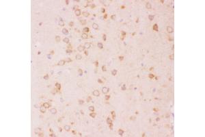 Anti-Tuberin Picoband antibody,  IHC(P): Rat Brain Tissue
